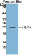 Western Blot;Sample: Recombinant TIMP1, Human.