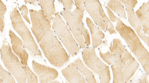 DAB staining on IHC-P; Samples: Human Skeletal muscle Tissue; Primary Ab: 20µg/ml Mouse Anti-Human VEGFR2 Antibody Second Ab: 2µg/mL HRP-Linked Caprine Anti-Mouse IgG Polyclonal Antibody