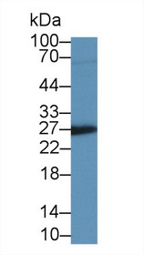 Western Blot; Sample: Rat Placenta lysate; Primary Ab: 2µg/ml Mouse Anti-Human IGFBP4 Antibody Second Ab: 0.2µg/mL HRP-Linked Caprine Anti-Mouse IgG Polyclonal Antibody