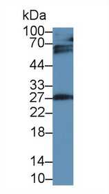 Western Blot; Sample: Rat Placenta lysate; Primary Ab: 2µg/ml Mouse Anti-Human IGFBP4 Antibody Second Ab: 0.2µg/mL HRP-Linked Caprine Anti-Mouse IgG Polyclonal Antibody