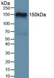 Western Blot; Sample: Rat Brain Tissue.