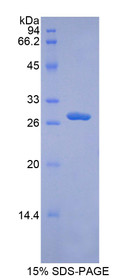 Figure 1. SDS-PAGE