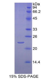 Figure 1. SDS-PAGE
