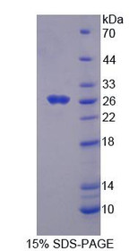 Figure 1. SDS-PAGE