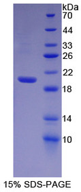 Figure 1. SDS-PAGE