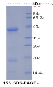 Figure 1. SDS-PAGE