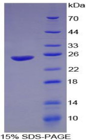 Figure 1. SDS-PAGE