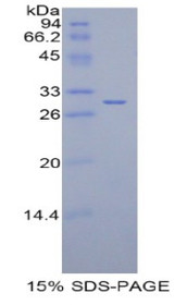 Figure 1. SDS-PAGE