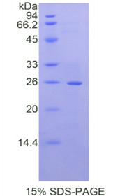 Figure 1. SDS-PAGE