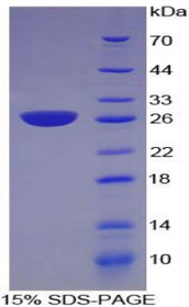 Figure 1. SDS-PAGE