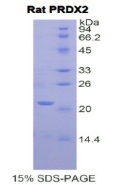 Figure 1. SDS-PAGE