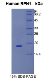Figure 1. SDS-PAGE