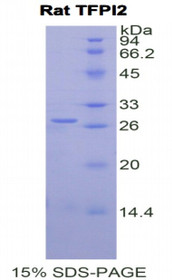 Figure 1. SDS-PAGE