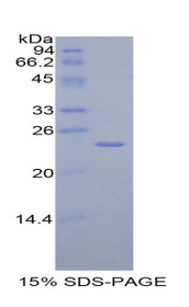 Figure 1. SDS-PAGE