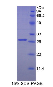 Figure 1. SDS-PAGE