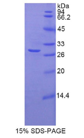 Figure 1. SDS-PAGE