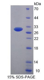 Figure 1. SDS-PAGE