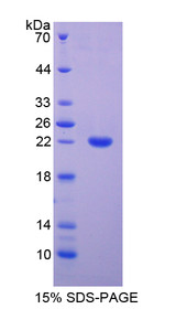 Figure 1. SDS-PAGE