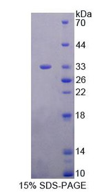 Figure 1. SDS-PAGE