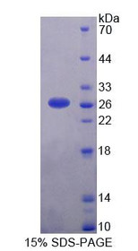 Figure 1. SDS-PAGE