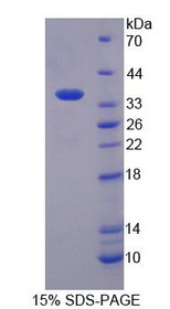 Figure 1. SDS-PAGE