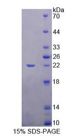 Figure 1. SDS-PAGE