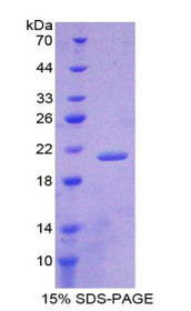 Figure 1. SDS-PAGE