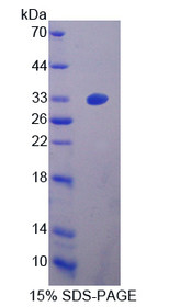 Figure 1. SDS-PAGE