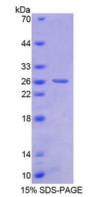Figure 1. SDS-PAGE