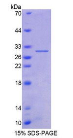 Figure 1. SDS-PAGE