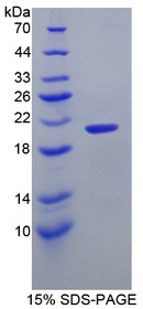 Figure 1. SDS-PAGE