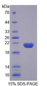 Figure 1. SDS-PAGE
