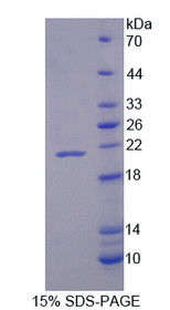 Figure 1. SDS-PAGE