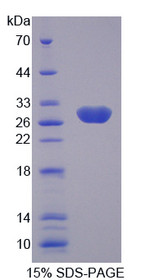 Figure 1. SDS-PAGE