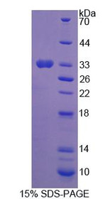 Figure 1. SDS-PAGE