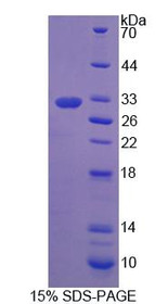 Figure 1. SDS-PAGE