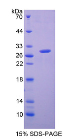 Figure 1. SDS-PAGE