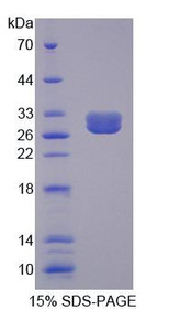 Figure 1. SDS-PAGE