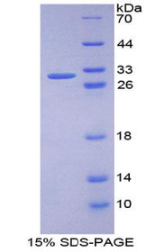 Figure 1. SDS-PAGE