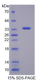 Figure 1. SDS-PAGE