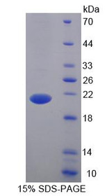Figure 1. SDS-PAGE