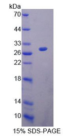 Figure 1. SDS-PAGE