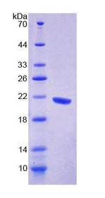 Figure 1. SDS-PAGE