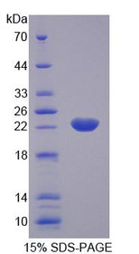 Figure 1. SDS-PAGE