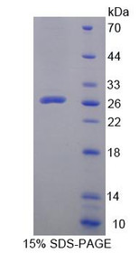 Figure 1. SDS-PAGE