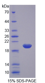 Figure 1. SDS-PAGE