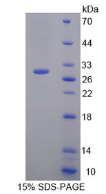 Figure 1. SDS-PAGE