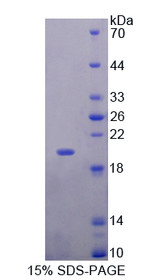 Figure 1. SDS-PAGE
