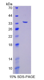Figure 1. SDS-PAGE