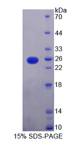 Figure 1. SDS-PAGE